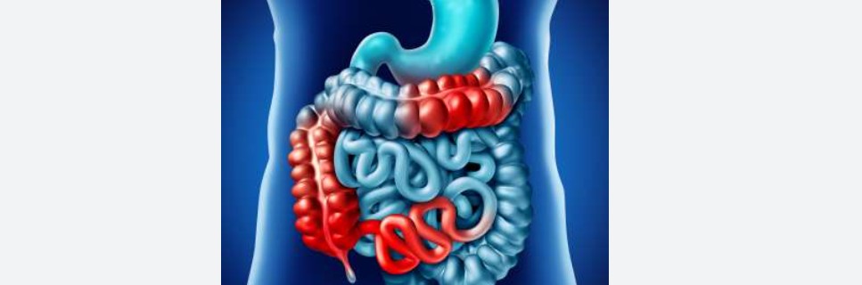 IBD image